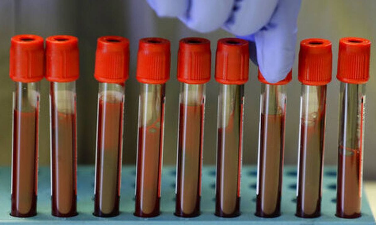 Εξέταση αίματος που μπορεί να εντοπίσει 50 τύπους καρκίνου ξεκινά να δοκιμάζει η Μεγάλη Βρετανία