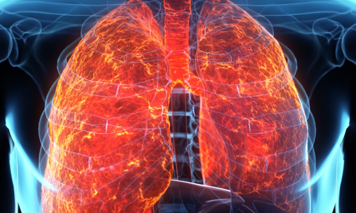 Υγρό στους πνεύμονες: Τα ανησυχητικά συμπτώματα (εικόνες)