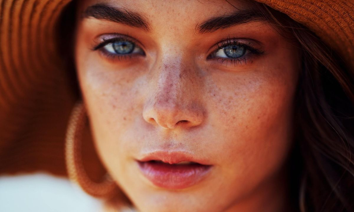 5 σημάδια στο δέρμα σου που φανερώνουν έλλειψη βιταμίνης D