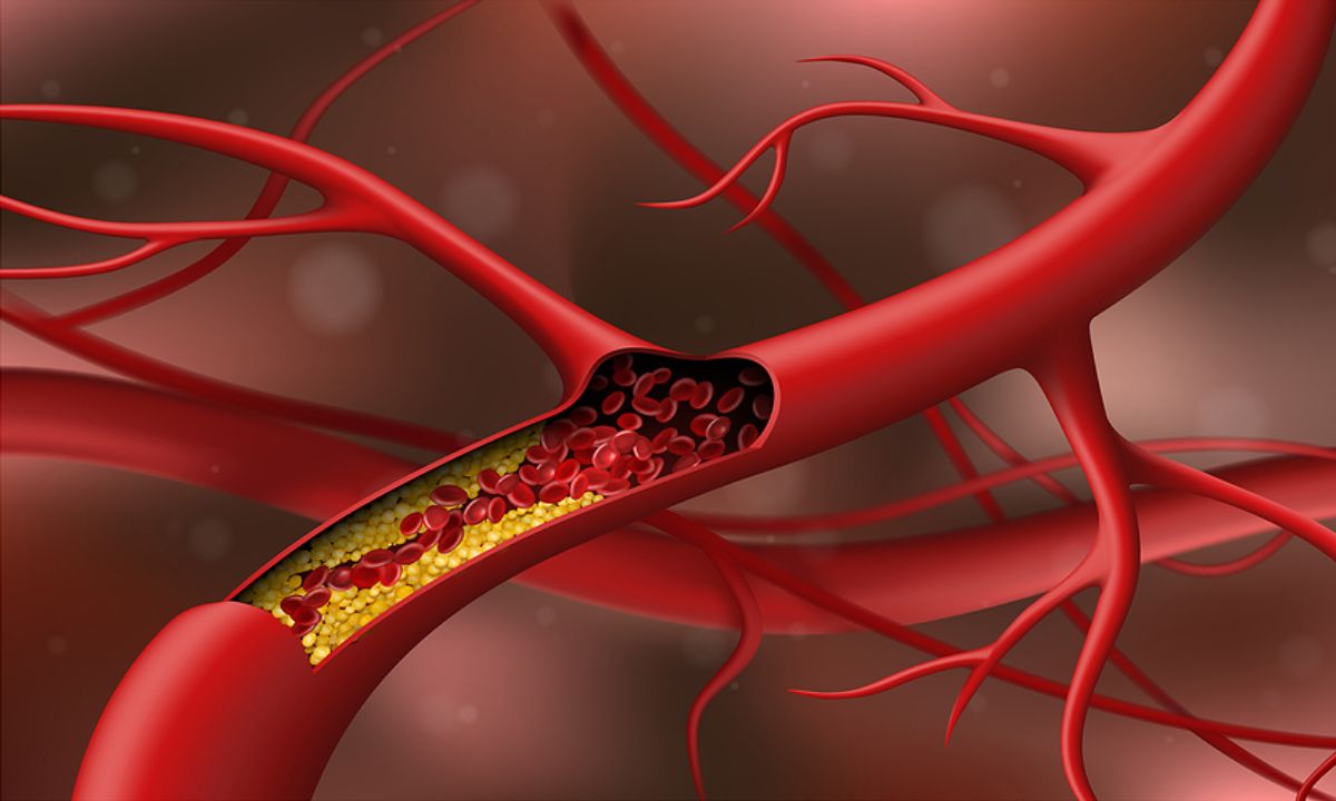 Οι 7 τροφές που μειώνουν τα επίπεδα της χοληστερίνης (βίντεο)