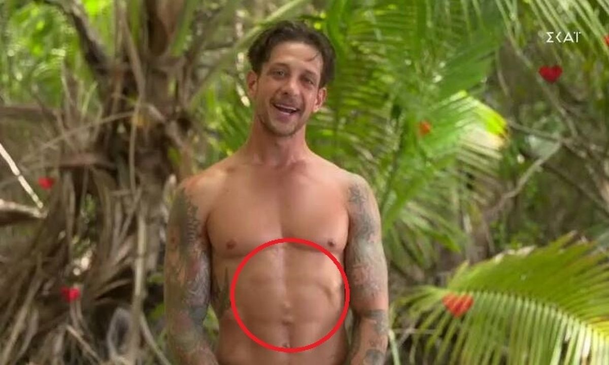 Survivor: Ηλίας Μπόγδανος: Το σοβαρό τροχαίο, η εντατική και η ουλή στην κοιλιά