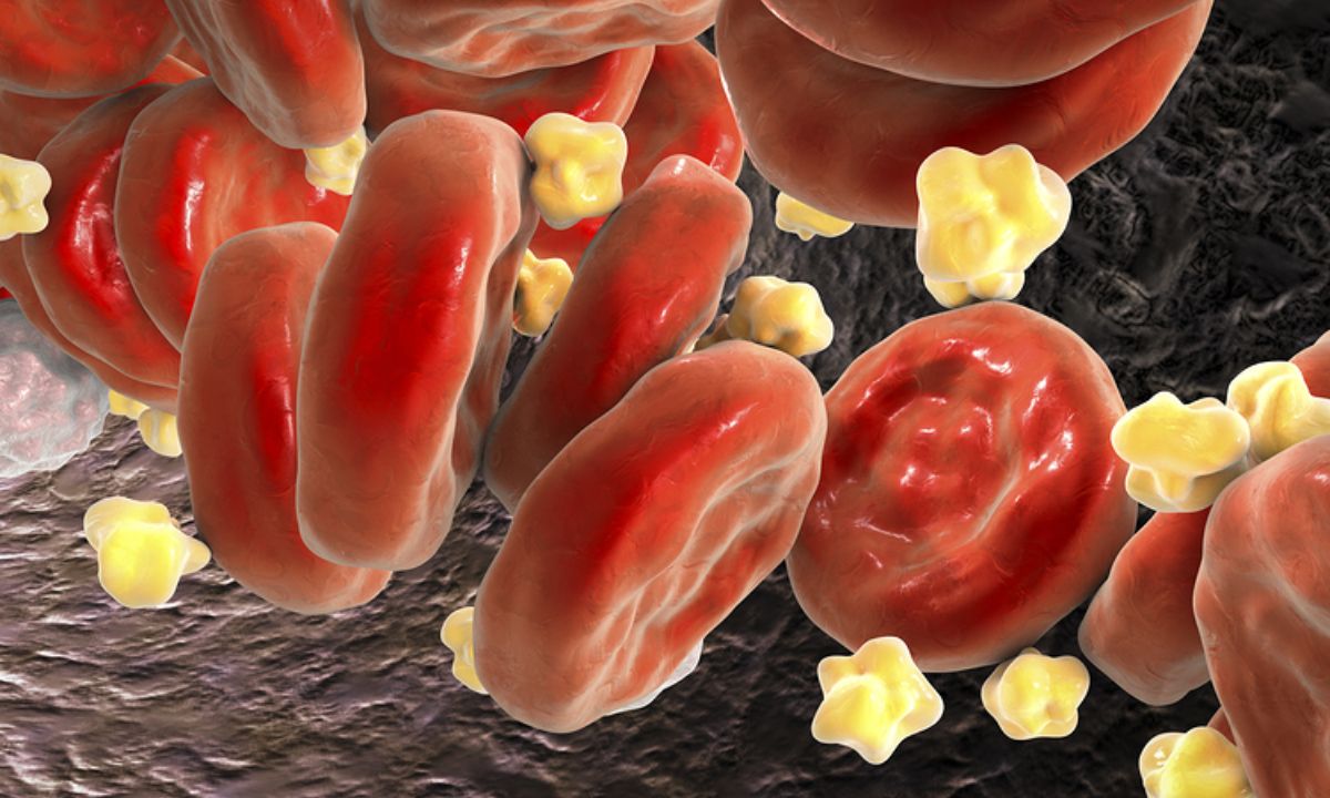 Πέντε πανεύκολα βήματα για τη μείωση της χοληστερίνης (εικόνες)