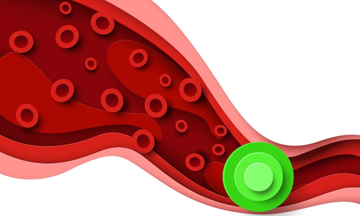 Χοληστερίνη: Διατροφικές αλλαγές για να τη μειώσετε (εικόνες)