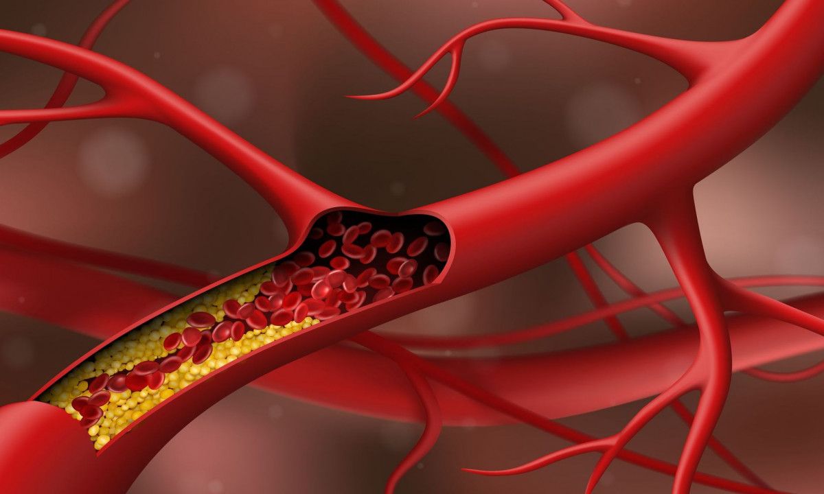 Υψηλή χοληστερόλη: Η κατανάλωση ωμέγα 3 συμβάλει στην προστασία της καρδιάς