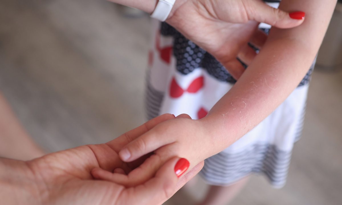 Τι βάζουμε στο κάψιμο;