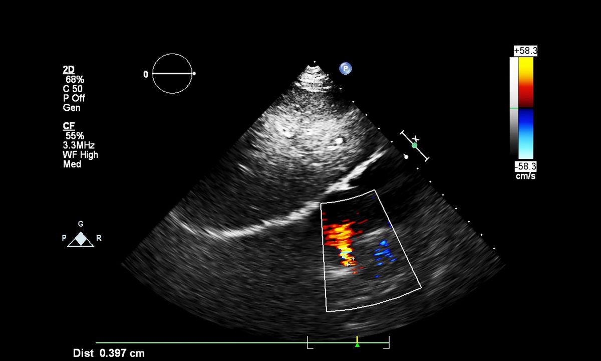 Επιστήμονες κατέγραψαν για πρώτη φορά σε εικόνες τον σχηματισμό καρδιάς σε έμβρυο (βίντεο)