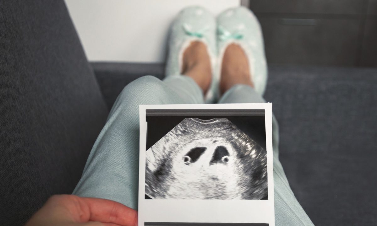 Σημεία «Τ» και «λ» στον υπέρηχο: Τι αποκαλύπτουν για τα δίδυμα