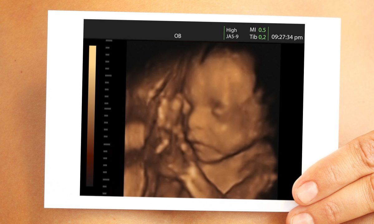 Καρδιοτοκογράφημα (Non-Stress Test/ NST): Μια ασφαλής και απλή μέθοδος παρακολούθησης του εμβρύου