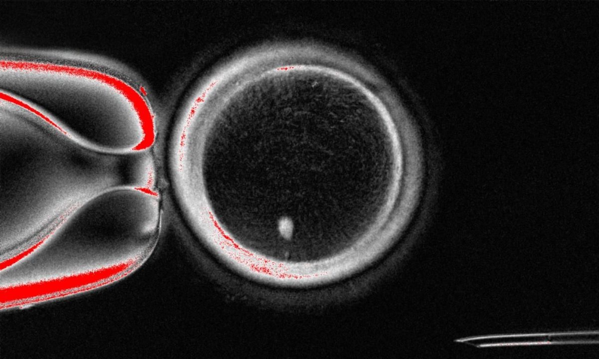 Ελπίδα για τα υπογόνιμα ζευγάρια: Δημιουργία ανθρώπινων εμβρύων από κύτταρα δέρματος
