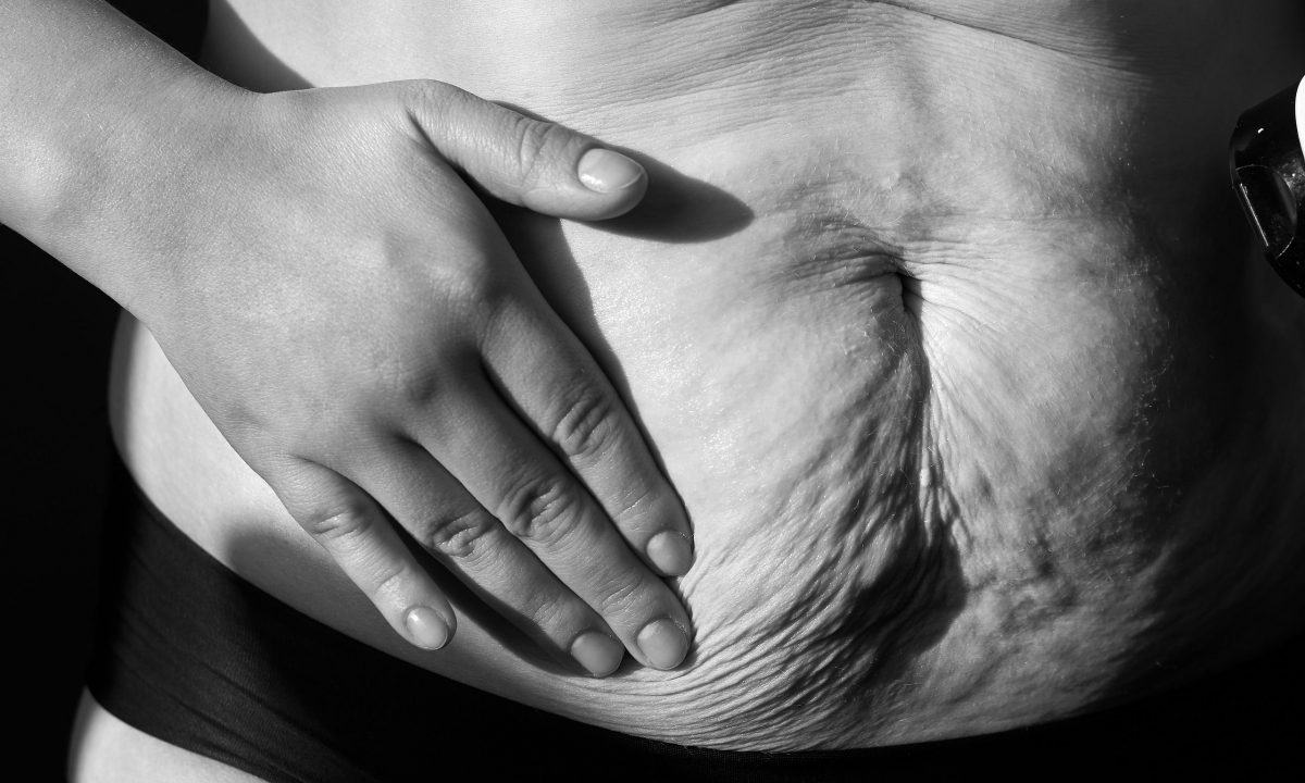 Ανασφάλειες για το σώμα: Η δυσκολία αποδοχής του μετά τη γέννα