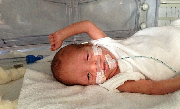 Τετράδυμα γεννήθηκαν 11 εβδομάδες νωρίτερα και επέζησαν! (φωτό)