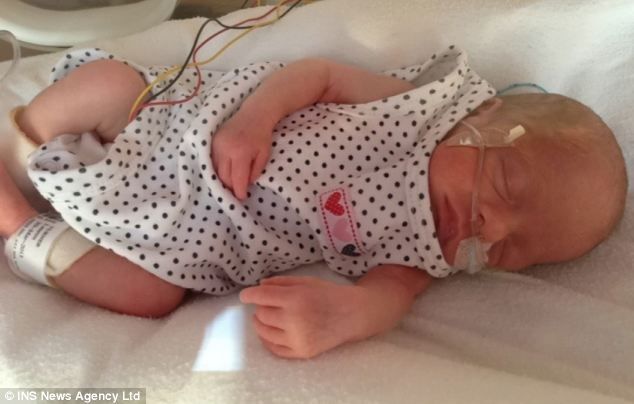 Τετράδυμα γεννήθηκαν 11 εβδομάδες νωρίτερα και επέζησαν! (φωτό)