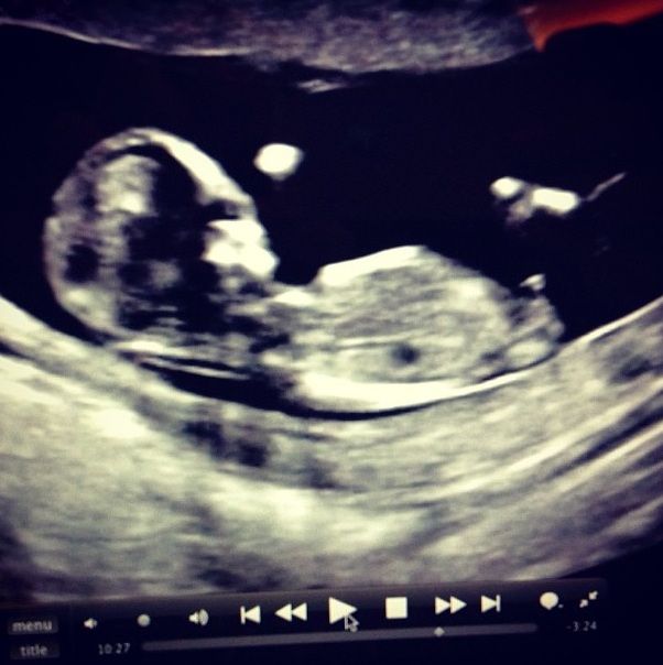 Τζένιφερ Στάνο Δαυίδ: Αυτό είναι το άλμπουμ της εγκυμοσύνης της (photos)