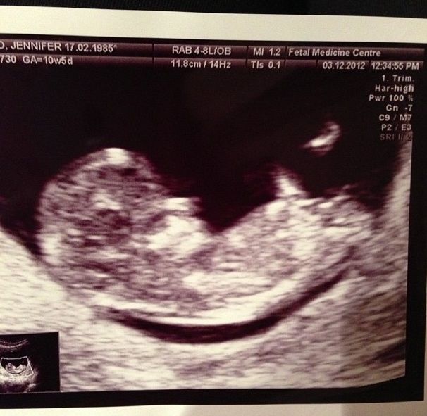 Τζένιφερ Στάνο Δαυίδ: Αυτό είναι το άλμπουμ της εγκυμοσύνης της (photos)