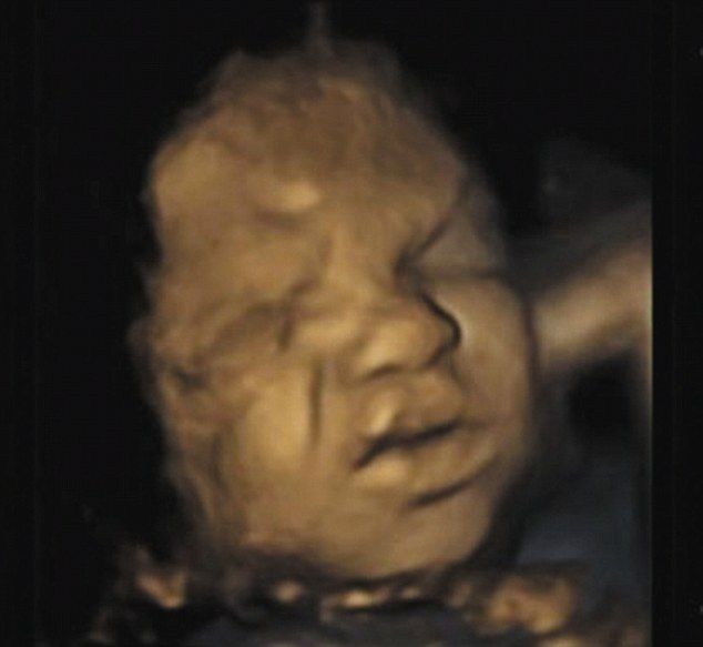 Tα αγέννητα μωρά εξασκούν τις εκφράσεις τους για τον τρόπο που θα αντιδρούν στον πραγματικό κόσμο! (φωτό)