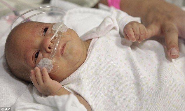 Γεννήθηκε στις 24 βδομάδες κύησης και τα κατάφερε!