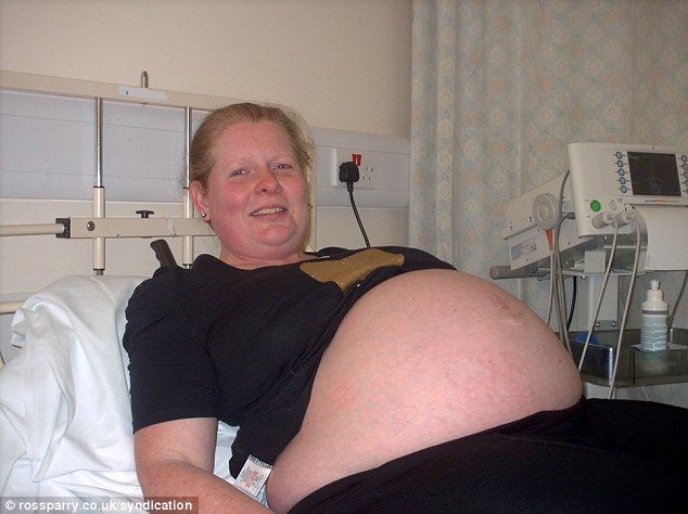 Απίστευτο: Δύο γάτες έσωσαν την ζωή μιας εγκύου‏