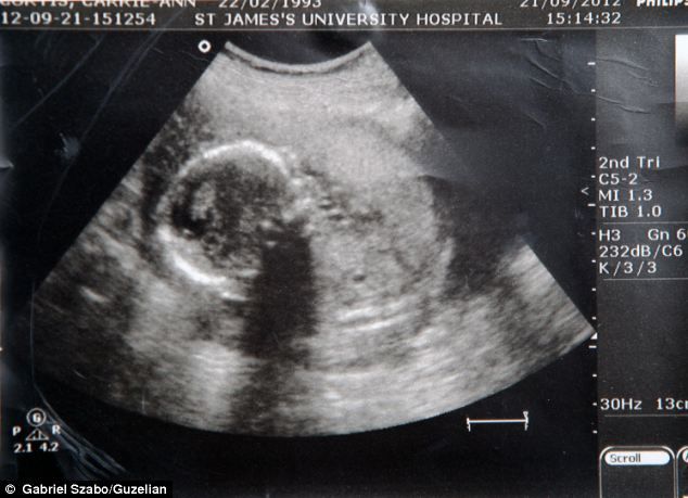 Έμεινε μαζί με το μωρό της για τρεις μέρες αφότου πέθανε!