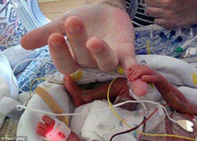 Γεννήθηκε στις 23 εβδομάδες κύησης και τώρα πάει σπίτι του!