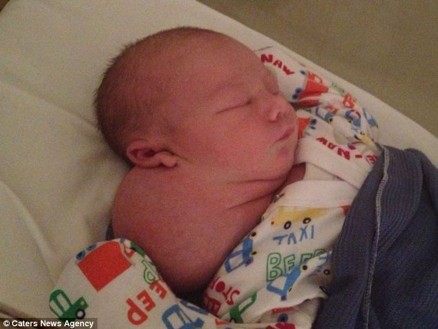 Η ιστορία του αγοριού που γεννήθηκε με τεράστια κύστη στον λαιμό!