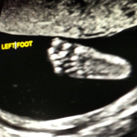 Η πρώτη φωτογραφία του γιου της Ιβάνκα Τραμπ και το άλμπουμ της εγκυμοσύνης της