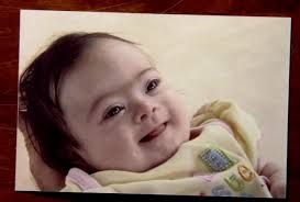 Όταν ένας πατέρας γίνεται στήριγμα ζωής για την κόρη του που πάσχει από σύνδρομο down! (συγκλονιστικό βίντεο)