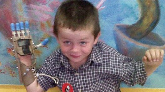 Δύο άγνωστοι δώρισαν σε 5χρονο αγοράκι το προσθετικό μέλος που χρειαζόταν! (εικόνες)