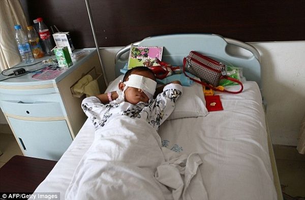 Η ιστορία του 6χρονου αγοριού με τα γυάλινα μάτια που συγκλόνισε τον κόσμο! (βίντεο, εικόνες)