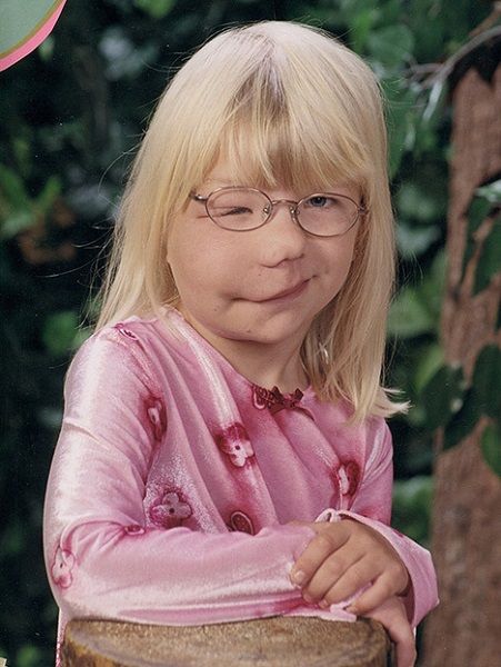 Καινούρια ζωή για την έφηβη που είχε όγκο στο μισό πρόσωπό της (φωτογραφίες+βίντεο)