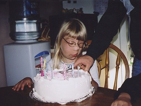 Καινούρια ζωή για την έφηβη που είχε όγκο στο μισό πρόσωπό της (φωτογραφίες+βίντεο)