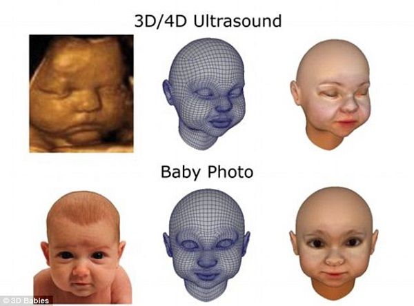 Hρθαν τα 3D babies! Μετατρέπουν σε τρισδιάστατη κούκλα φυσικού μεγέθους, το αγέννητο μωρό μας! (εικόνες)