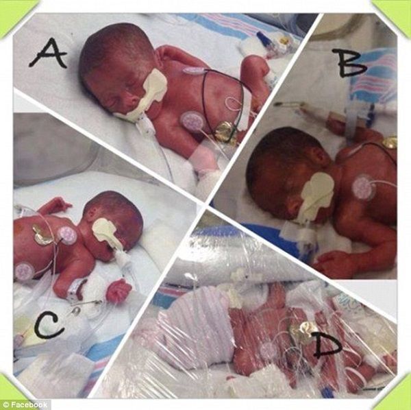 Απίστευτο! Ηξερε ότι περιμένει τρίδυμα και τελικά γέννησε τετράδυμα! (εικόνες, βίντεο)