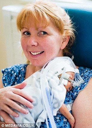 Πατέρας φωτογραφίζει την πρόοδο του μικροσκοπικού πρόωρου μωρού του (φωτογραφίες)