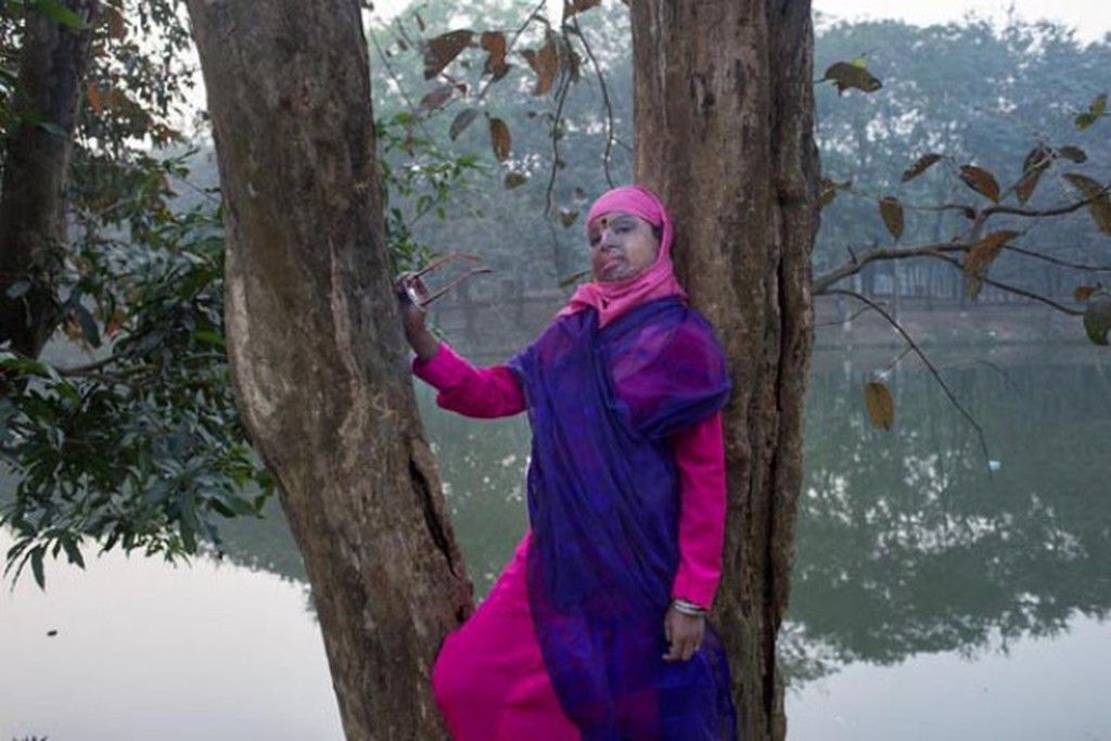 Η «ομορφιά» και η ιστορία μιας ουλής. Φωτογραφίες γυναικών που τους επιτέθηκαν με βιτριόλι