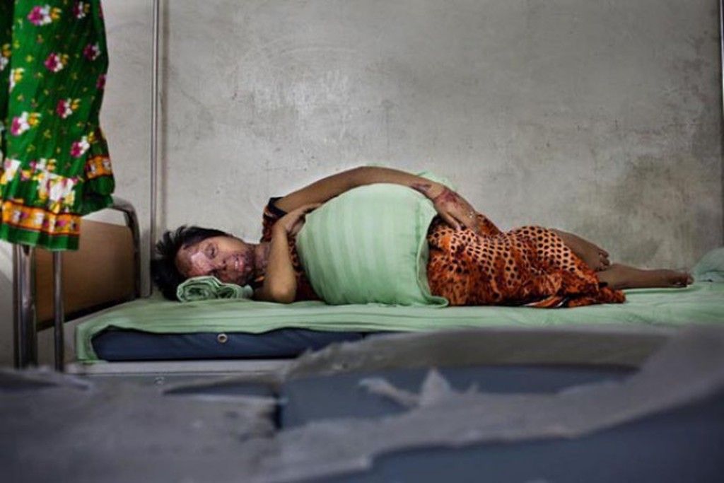 Η «ομορφιά» και η ιστορία μιας ουλής. Φωτογραφίες γυναικών που τους επιτέθηκαν με βιτριόλι