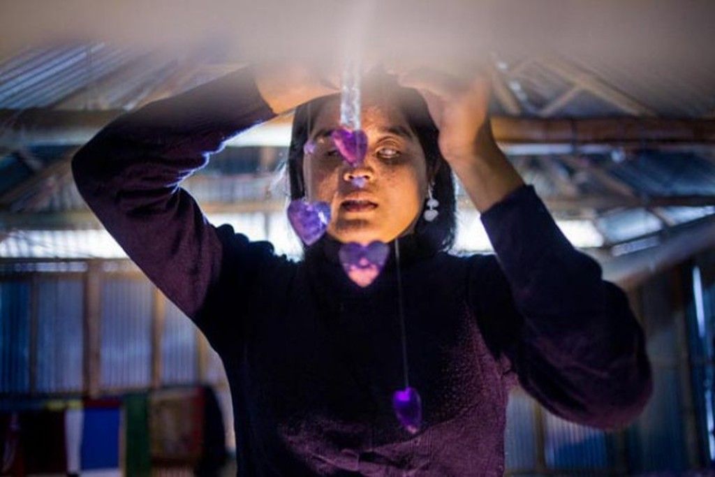 Η «ομορφιά» και η ιστορία μιας ουλής. Φωτογραφίες γυναικών που τους επιτέθηκαν με βιτριόλι