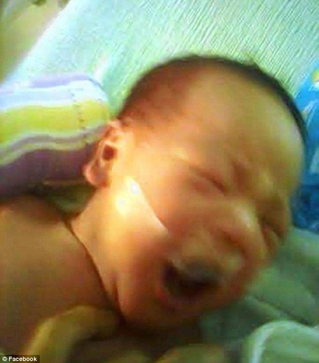 Απίστευτο! Εκλεισαν το στόμα βρέφους με κολλητική ταινία σε μαιευτήριο των Φιλιππίνων!