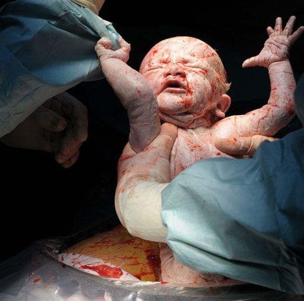 H γέννηση! Οταν το θαύμα της ζωής μας αφήνει άφωνους. Δείτε τις συγκλονιστικές φωτογραφίες!