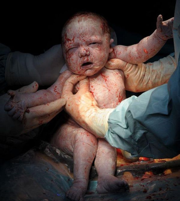 H γέννηση! Οταν το θαύμα της ζωής μας αφήνει άφωνους. Δείτε τις συγκλονιστικές φωτογραφίες!