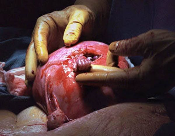 H γέννηση! Οταν το θαύμα της ζωής μας αφήνει άφωνους. Δείτε τις συγκλονιστικές φωτογραφίες!