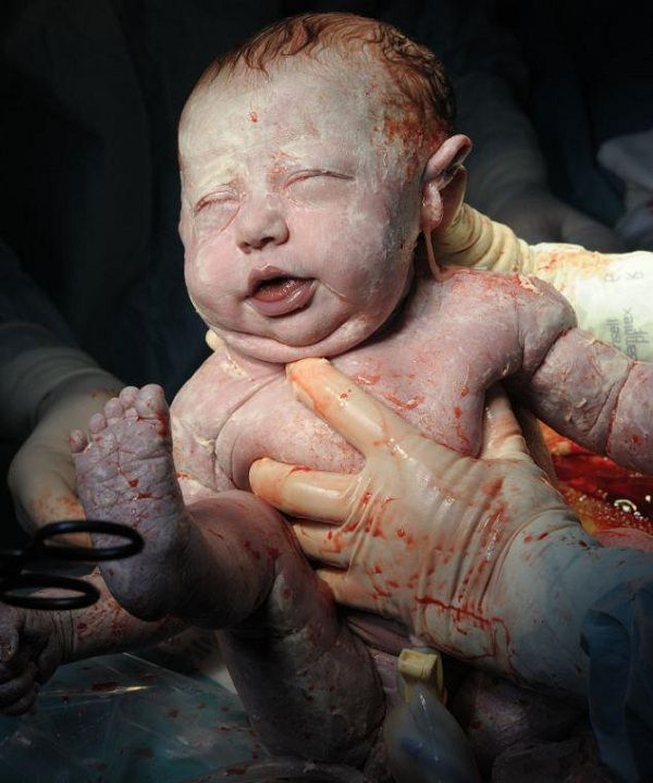 H γέννηση! Οταν το θαύμα της ζωής μας αφήνει άφωνους. Δείτε τις συγκλονιστικές φωτογραφίες!