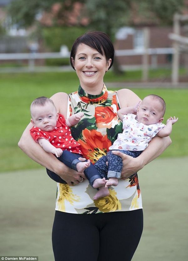 Τα πρόωρα διδυμάκια που σώθηκαν χάρη στα πλαστικά σακουλάκια τροφίμων! (εικόνες)