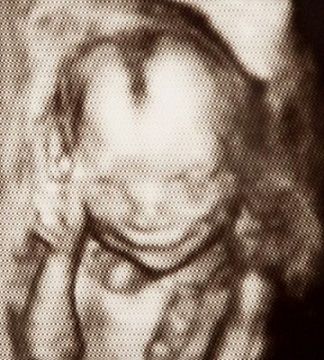 «Μα τι έχω μέσα στην κοιλιά μου»; Αυτοί είναι οι πιο περίεργοι υπέρηχοι που έχετε δει!