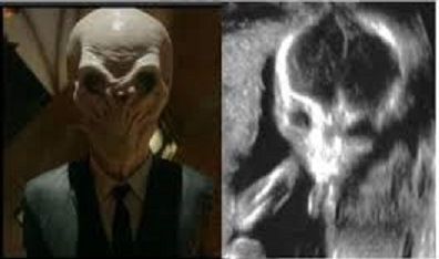 «Μα τι έχω μέσα στην κοιλιά μου»; Αυτοί είναι οι πιο περίεργοι υπέρηχοι που έχετε δει!