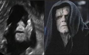 «Μα τι έχω μέσα στην κοιλιά μου»; Αυτοί είναι οι πιο περίεργοι υπέρηχοι που έχετε δει!