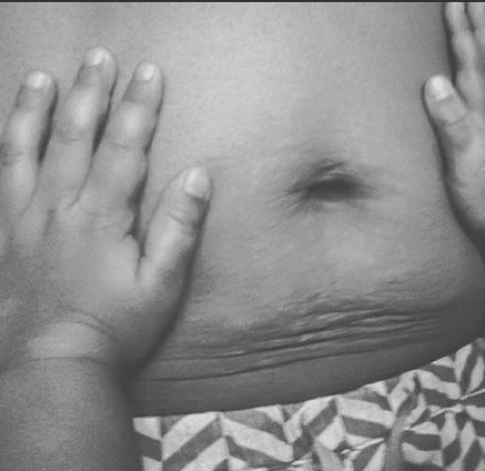 «Αγαπήστε τα σημάδια της εγκυμοσύνης σας»! Μία αλλιώτικη ομάδα με 25000 followers!