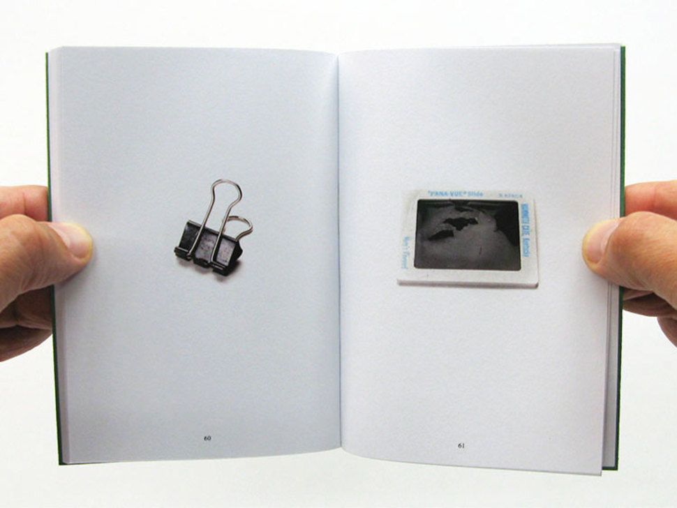 Η περίεργη συλλογή μιας μαμάς, από αντικείμενα που έβγαλε από το στόμα του παιδιού της!