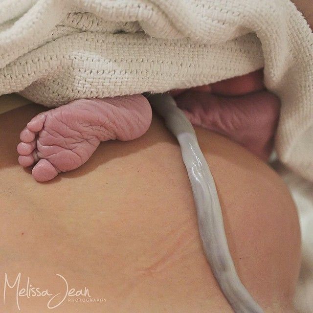 Αυτές είναι οι φωτογραφίες μητρότητας και γέννας, που το Instagram διέγραψε και απαγόρευσε!