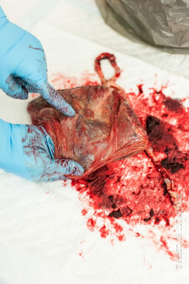 Έτσι είναι ο πλακούντας. Μοναδικές εικόνες