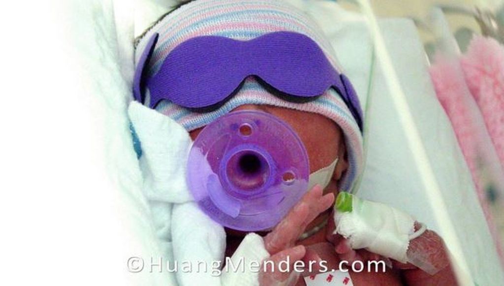 3. Φορά πιπίλα ενώ τα ματιά της είναι καλυμμένα λόγω κάποιας φωτοθεραπείας.